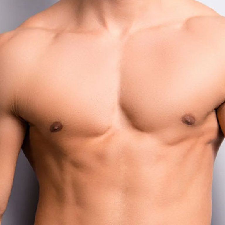علاج تثدى الرجال