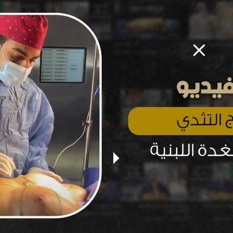 علاج تثدي الرجل
