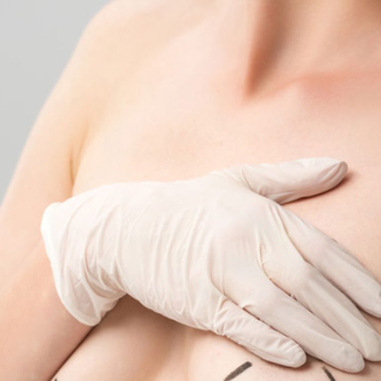 علاج ترهلات الثدى