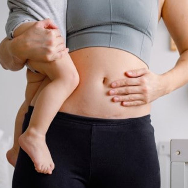 عمليات تجميل الأمومة