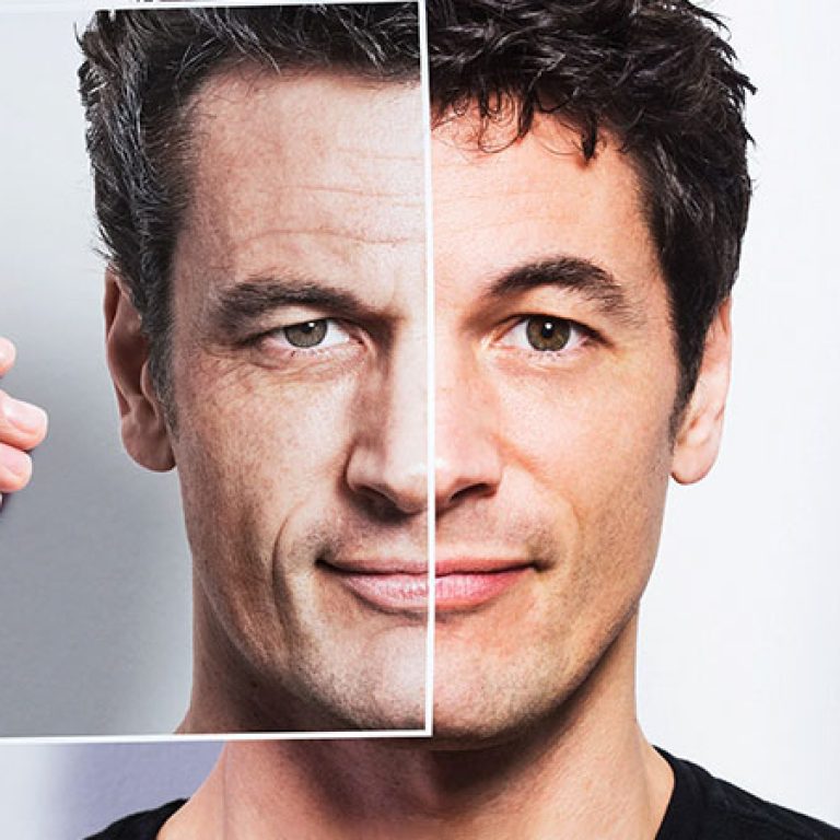 عمليات تجميل الرجال