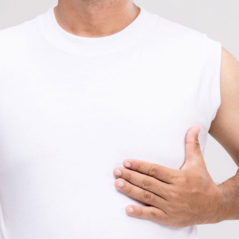 عملية التثدي عند الرجال بالليزر