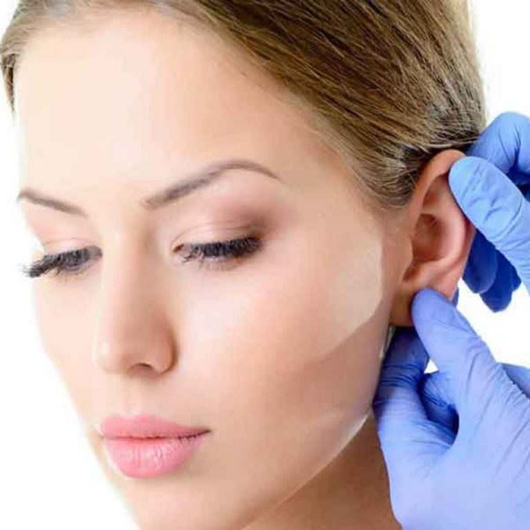 عملية تجميل الاذن