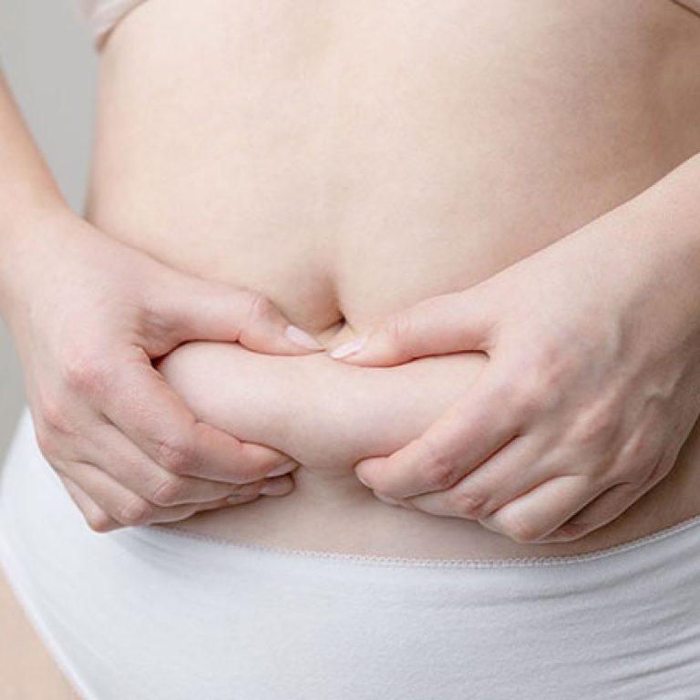 عملية تجميل البطن