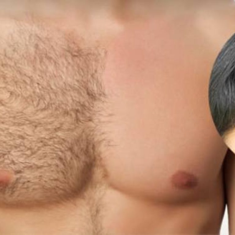 هل يمكن زراعة الشعر من شعر الجسم (1)